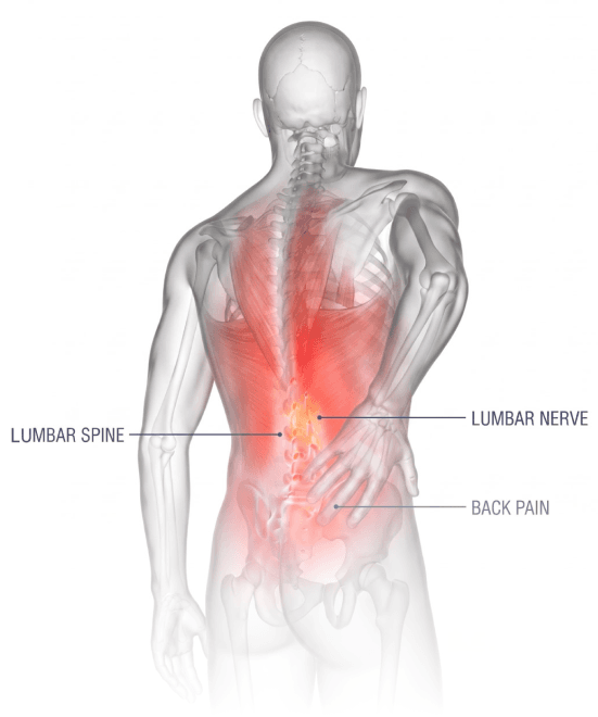 Illustration of the lumbar spine and sciatic nerve pathway highlighting the sacroiliac joint, pelvis, and femur